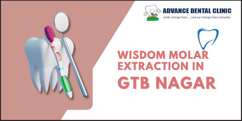 Wisdom Molar Extraction In Gtb Nagar | Advance Dental Clinic